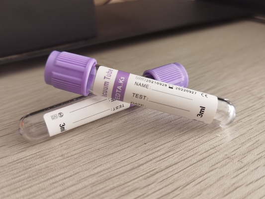 Ψεκασμένη K3edta Vacuum 2ml ετικέτα cOem μπουκαλιών εξετάσεων αίματος γυαλιού πορφυρή