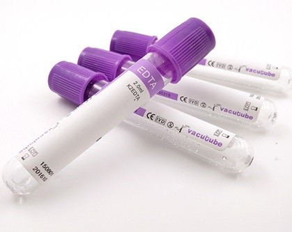 EDTA JINGZ 0.5ml-10ml K2 σωλήνας για το κενό εξετάσεων αίματος σύμφωνα με το ύψος